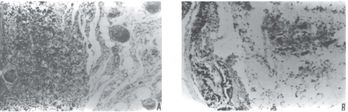 FIGURE 4- Response of the connective tissue in contact with Ketac Endo cement (arrows): 14-day experimental period (A) and 90-day experimental period (B)