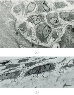Figure 2: Electron micrographs of portions of alveolar bone of rats.