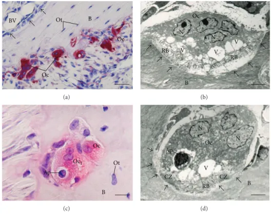 Figure 4: Light (a and c) and electron micrographs (b and d) of portions of alveolar bone of rats