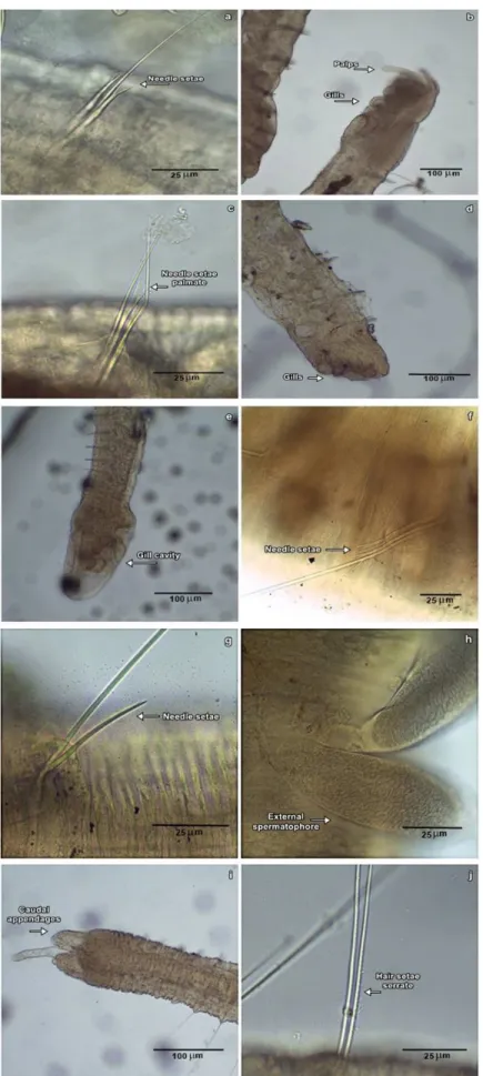 Figure 2. a: Needle setae of Allonais inaequalis; b: Gill cavity of Aulophorus furcatus;  c: Needle setae palmate of Aulophorus costatus;  d: Gills of Dero digitata; 