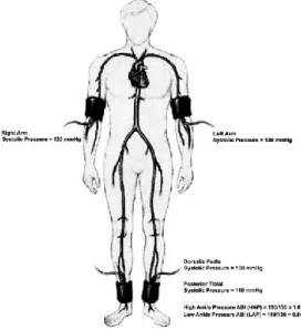 Figura  5  -  Determinação  do  índice  tornozelo  braço  (ITB).  Adaptado  de  Khan  et  al,  2005