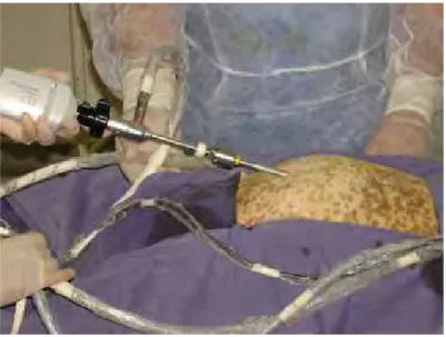 Figura 2 – Imagem fotográfica ilustrando a cânula do endoscópio acoplado a microcâmera e cabo de fibra ótica.