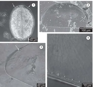 Figura 1-4. Microscopia ótica de Palmerina hardmaniana. 1) Visão geral de  uma frústula (célula viva) com diversos cloroplastos e macrorimoportulae na margem (setas)