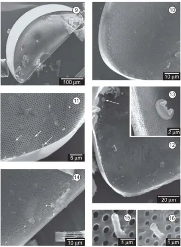 Figura 9-16.Microscopia eletrônica de varredura de Palmerina hardmaniana.