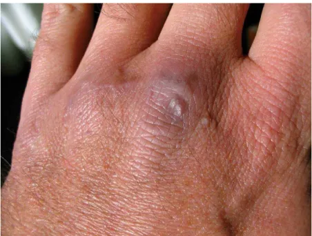 Figure 4. Total recovery of the wound after four months. 