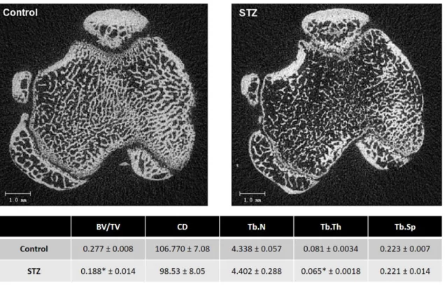 Figure 3.1 - Top: representative 2D microtomographic images of the proximal tibia  methaphysis,  in  control  and  STZ  animals  (
