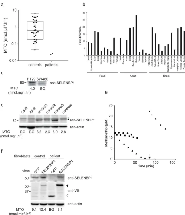 Figure 4. Analysis of SELENBP1 expression and MTO activity in human cell lines