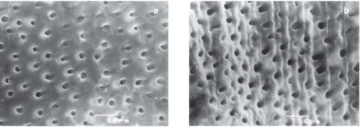 FIGURE 4- Dentin surface cut by: a) carbide bur after 37% phosphoric acid etching; b) diamond bur after 37% phosphoric acid etching (Original magnification 1500X, bar=10µm)