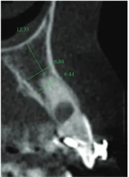 Figure 3: Initial computed tomography.