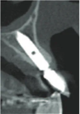 Figure 6: Esthetic restoration.