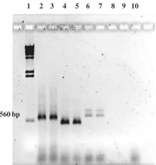 FIG . 3. Produto de amplificação de PCRs obtidos de extrato cru de esporo único de fungos micorrízicos arbusculares e de raízes de  ca-feeiro colonizadas ou não, usando os primers ITS 4 e 5 combinados