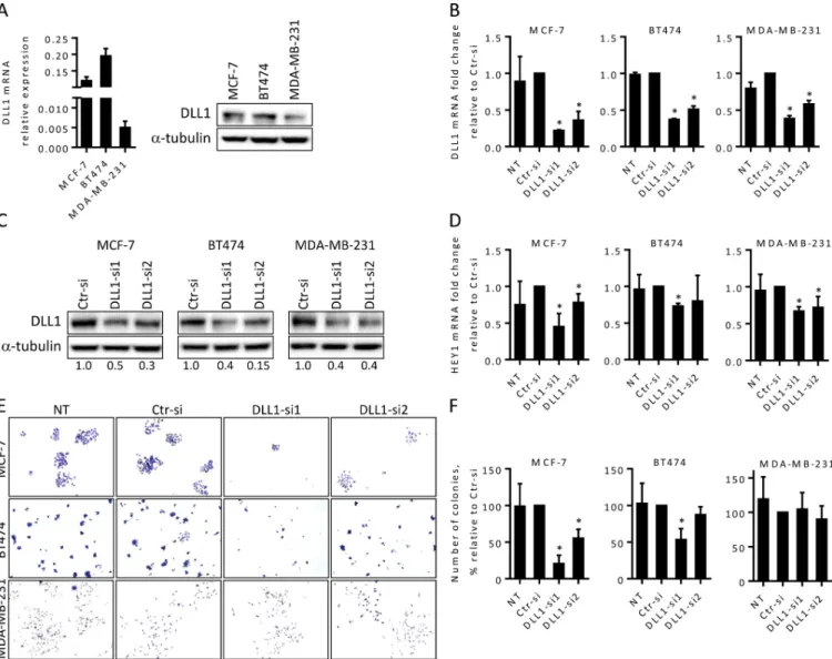 Fig 1. DLL1 downregulation impairs Notch pathway activation in BC cells and decreases MCF-7 and BT474 colony formation abilities