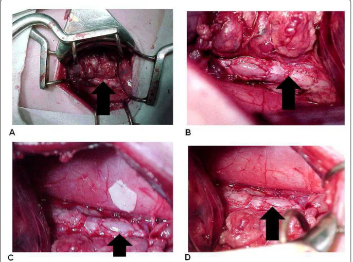 Figure 1 (A) Overview of the surgical field. (B) Retail is implanted in the abdominal aorta