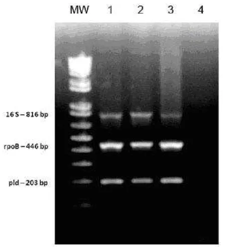 Figure 2. Multiplex polymerase-chain reaction (m-PCR). MW: molecular weight marker (1  kb plus ladder)