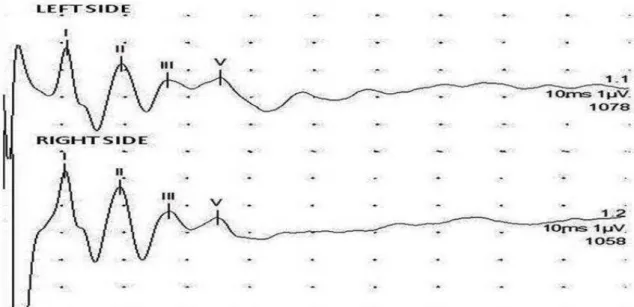 Figure  1.  Dalmatian  dog.  Brainstem  auditory  evoked  response  tracing  obtained  from  a  normal  adult  animal