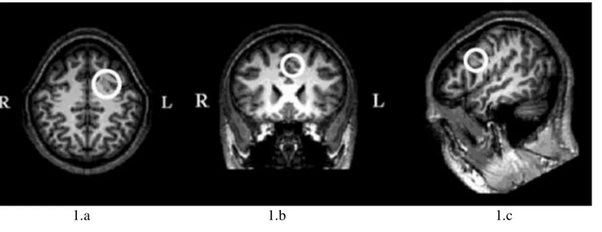 Figura 2: Regiones del cerebro 