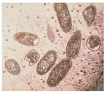 Figure 1. Electron microscopy of Rickettsia rickettsii (21). 