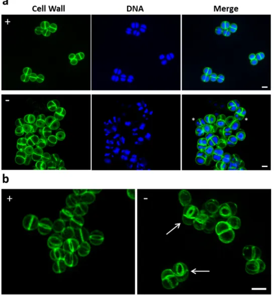 Figure 2.  Loss of FemAB activity inhibits daughter cell separation during division. (a) SIM images of MW2- MW2-iFemAB cells grown in the presence (+) or absence (−) of IPTG and labelled with cell wall dye Van-FL and  DNA dye Hoechst 33342
