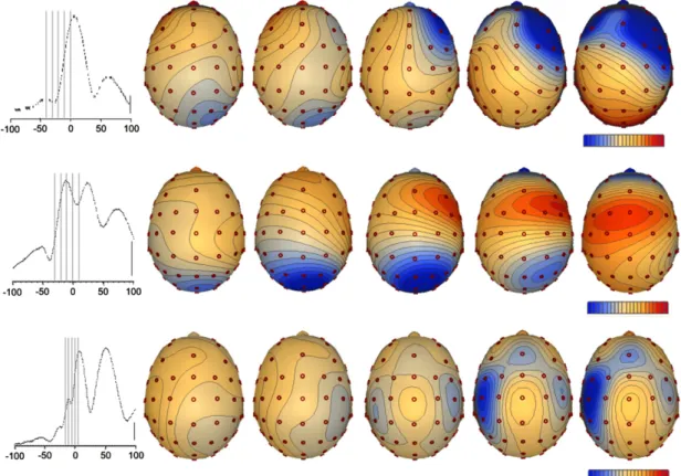 Fig. 1. Maps of scalp potential at several moments in time, from spike onset till spike peak