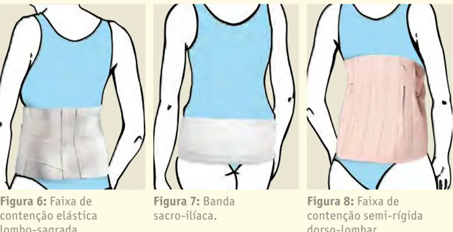 Figura 6: Faixa de  contenção elástica  lombo-sagrada.