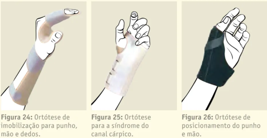 Figura 24: ortótese de  imobilização para punho,  mão e dedos. Figura 25: ortótese para a síndrome do canal cárpico