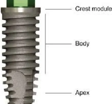 Figura 3. As 3 partes do implante: o colo, o corpo e o apex 