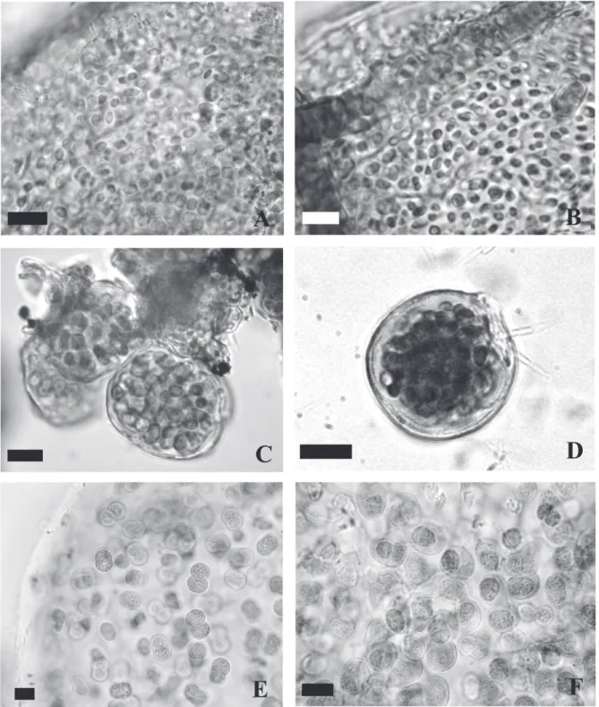 Figure 1. A-B. Aphanothece coacervata. C-D. A. densa. E-F. A. excentrica. Scale bars = 10μm