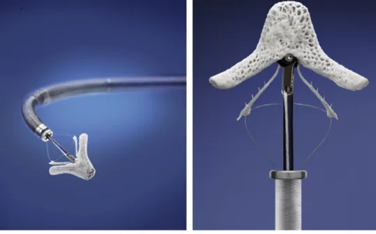 Figure 2 The MitraClip device.