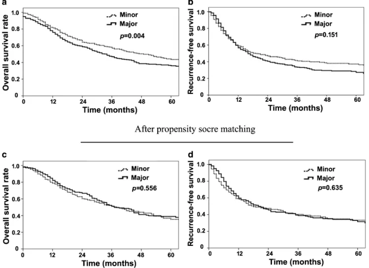 Fig. 1 Overall survival (a, c) and recurrence-free survival (b, d) before and after propensity score matching of patients undergoing major and minor hepatectomy for intrahepatic cholangiocarcinoma