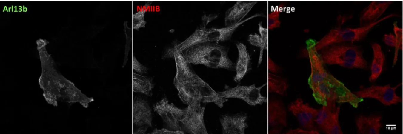 Figure 4.4 – Co-immunoprecipitation of non-muscular myosin IIA with Arl13b in MDA-MB-231 cells