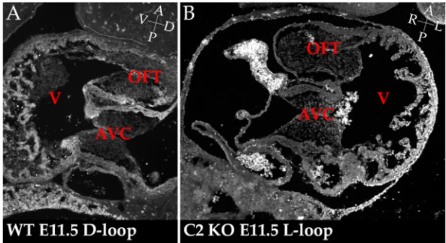 Figure 3. Incorrectly looped hearts in Cerl2 mutant embryos. Sagittal section of a wild-type (WT) (A)  and coronal section of Cerl2 mutant (B) hearts after looping stages, at developmental stage E11.5