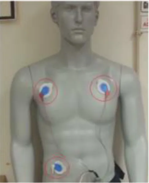 Figure 7 Example of electrode body placement 