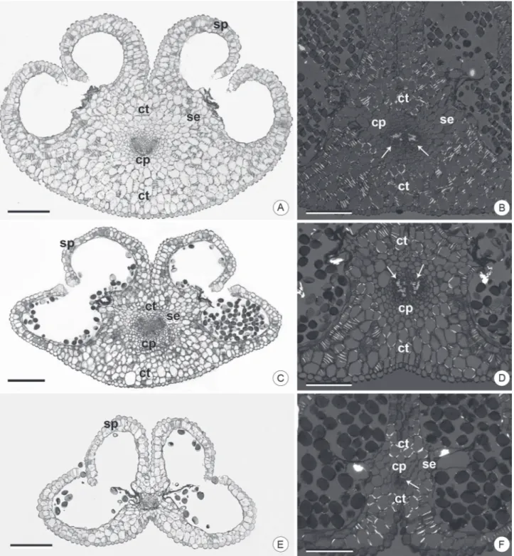 Figure 2.  Anthers of Dyckia species in median cross section. A, B: D. ibicuiensis. C, D: D