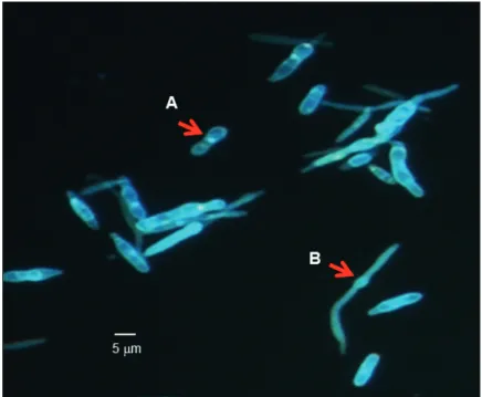 Table 2.  Light microscope study of the morphologies of 26 Ustilago maydis strains and their partial-diallelic arrangements evaluated  on PDA medium supplemented with a 5 % carbon source.