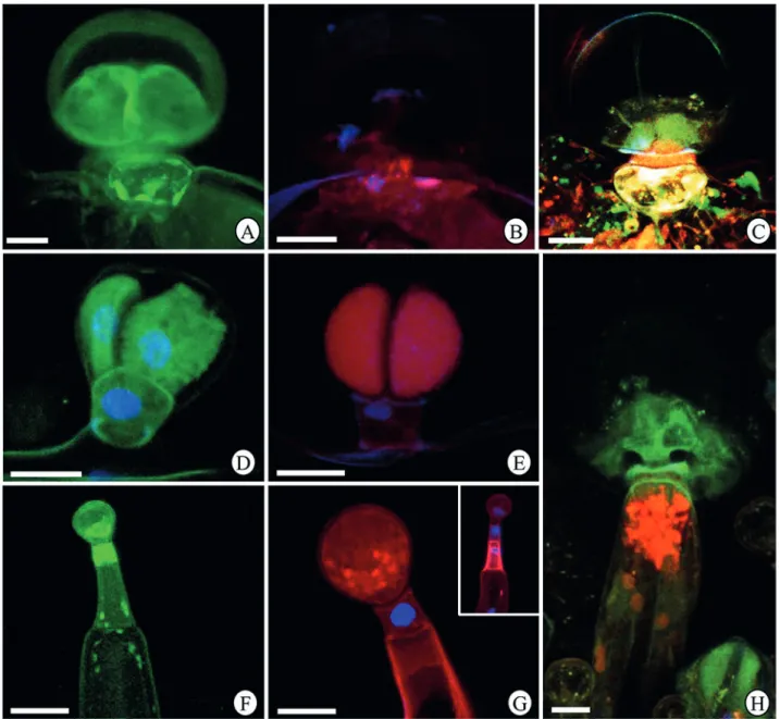 Figure 7.  Imunolabeling of cytoskeletal elements in the glandular trichomes in Hyptis villosa leaf blade under confocal microscopy
