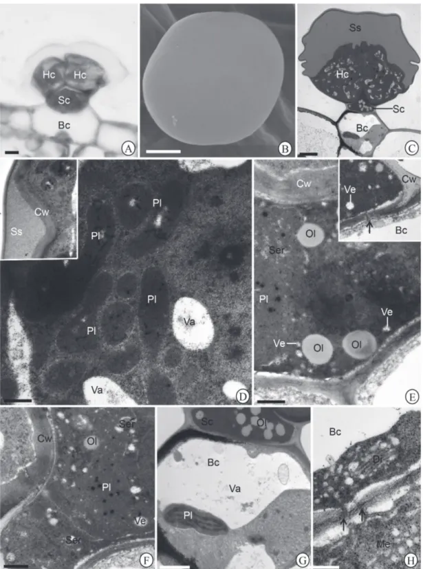 Figure 2.  Morphotype I of glandular trichome in Hyptis villosa leaf blade. (A) Light microscopy showing glandular trichome with  head cells (Hc), stalk cell (Sc) and a basal cell (Bc)