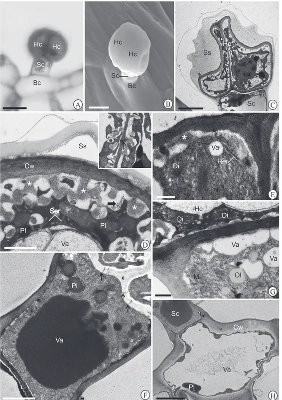 Figure 3.  Morphotype II of glandular trichome in Hyptis villosa leaf blade. Glandular trichome under (A) light and (B) scanning  electron microscopy constituted by two head cells (Hc), a stalk cell (Sc) and a basal cell (Bc)