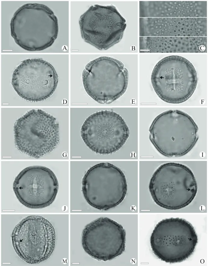 Figure 1. Light micrographs of Waltheria L. pollen grains. Waltheria ackermanniana (Reticulate): A