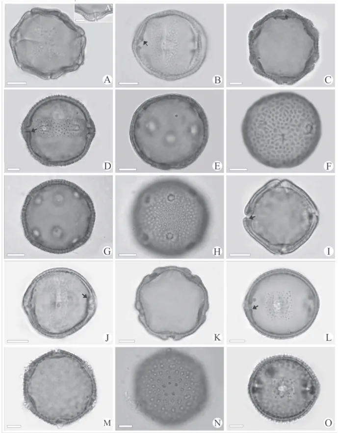 Figure 2. Light micrographs of Waltheria L. pollen grains. W. cinerascens (Reticulate): A