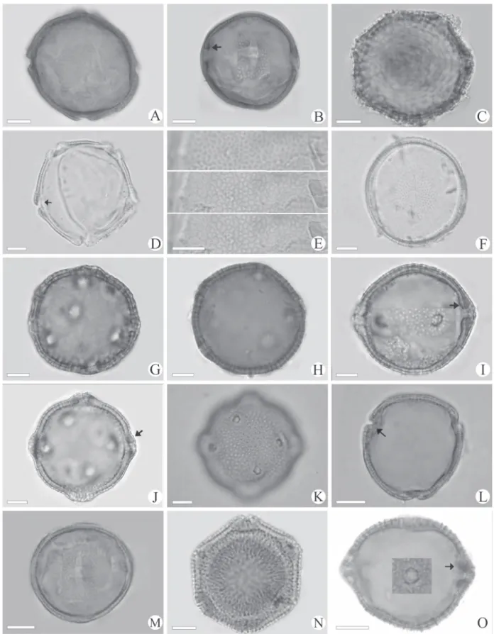 Figure 3. Light micrographs of Waltheria L. pollen grains. W. macropoda (Reticulate): A
