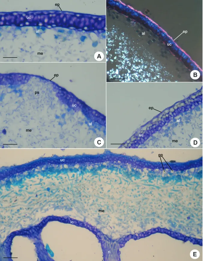 Figure 1.  Transversal section of Th   allus structure.  A. Punctelia. aff .  graminicola 2 showing epicortex, upper cortex and medulla