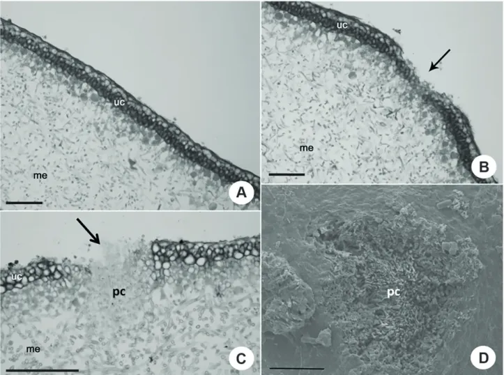 Figure 2.  Pseudocyphellae ontogeny and structure – Transversal section of P. roseola showing the pseudocyphellae formed from the  outside to inside of the thallus