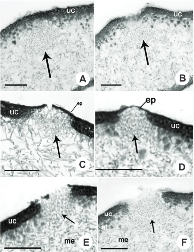 Figure 3.  Pseudocyphellae ontogeny and structure – Transversal section showing the pseudocyphellae formed from the inside to  outside of the thallus