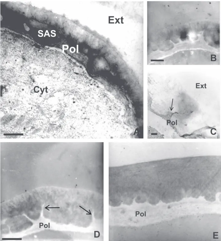 Figure 2.  Transmission electron microscopy of the outer cell wall of the epidermis of colleters of Bathysa nicholsonii