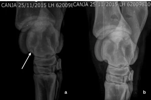 Figura 12 - Imagem radiológica de articulação do tarso, projeção dorsomedial-plantarolateral,  com  presença  de  fragmento  de  OCD  (seta),  antes  (a)  e  após  a  sua  remoção  cirúrgica  por  artroscopia (b).