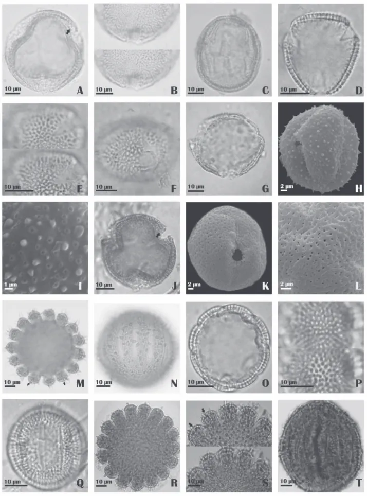 Figure 1. A-T. Photomicrographs and electron photomicrographs of pollen grains of the family Rubiaceae