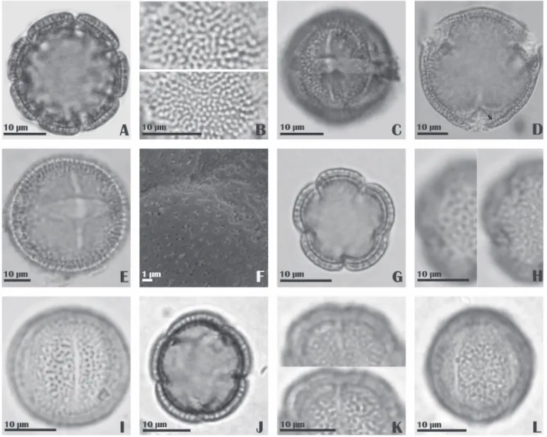 Figure 2. A-L. Photomicrographs and electron photomicrographs of pollen grains of the family Rubiaceae
