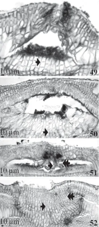 Fig. 15). The presence of cavity cells in mature sporangial  conceptacles in this species was previously reported by  Harvey et al