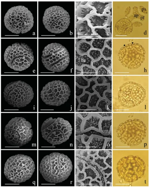 Figure 1. Pollen grains of Passiflora edulis f. flavicarpa O. Deg using a scanning electron microscope (SEM) and a  light microscope (LM)