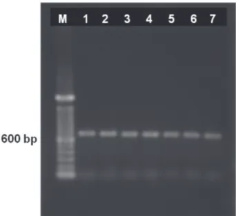 FIGURE 2 - Products of IC-RT-PCR, using Potexvirus universal  primers, on RNA obtained from leaf extracts of cassava cultivar  Olho  Junto  grown  from  meristem-tip  culture  combined  with  thermotherapy, which tested negative for CsCMV in PTA-ELISA